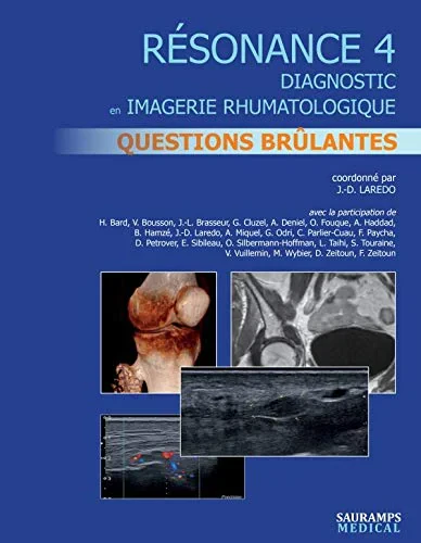Coperta cărții "RESONANCE 4 - QUESTIONS BRULANTES" de LAREDO J-D