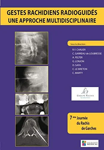 Coperta cărții "GESTES RACHIDIENS RADIOGUIDES - UNE APPROCHE MULTIDISCIPLINAIRE" de CARLIER R.Y.