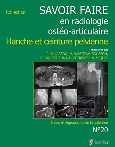 Coperta cărții "SAVOIR FAIRE EN RADIOLOGIE OSTEO-ARTICULAIRE N�20" de LAREDO JEAN-DENIS
