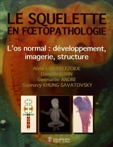 Coperta cărții "LE SQUELETTE EN FOETOPATHOLOGIE" de DELEZOIDE ANNE-LISE