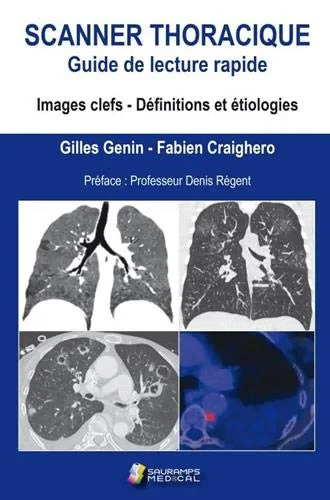 Coperta cărții "SCANNER THORACIQUE" de GENIN GILLES