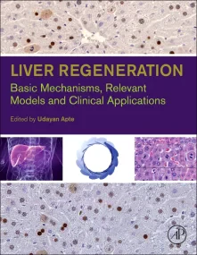 Liver Regeneration: Basic Mechanisms, Relevant Mod...