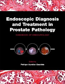 Endoscopic Diagnosis and Treatment in Prostate Pat...