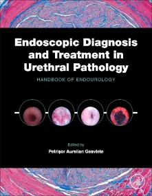 Endoscopic Diagnosis and Treatment in Urethral Pat...