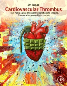 Cardiovascular Thrombus: From Pathology and Clinic...