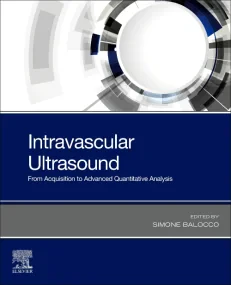 Intravascular Ultrasound: From Acquisition to Adva...