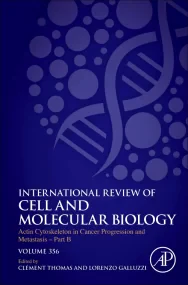 Actin Cytoskeleton in Cancer Progression and Metas...
