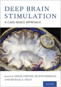 Deep Brain Stimulation: A Case-Based Approach