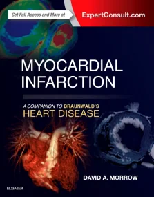 Myocardial Infarction: A Companion to Braunwald’s ...