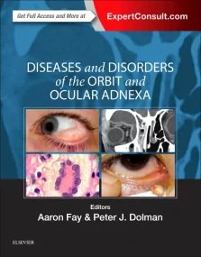 Diseases and Disorders of the Orbit and Ocular Adn...