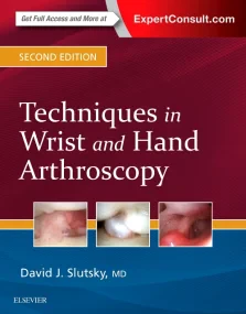 Techniques in Wrist and Hand Arthroscopy, 2nd Edit...