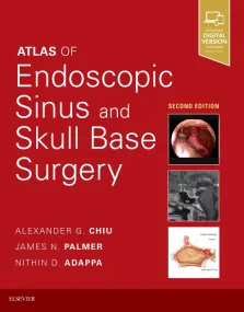 Atlas of Endoscopic Sinus and Skull Base Surgery, ...