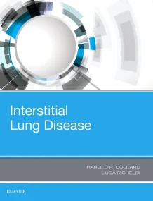 Interstitial Lung Disease, 1e