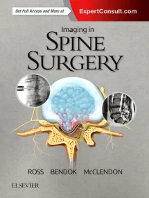 Imaging in Spine Surgery, 1e