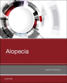 Alopecia