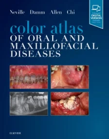 Color Atlas of Oral and Maxillofacial Diseases, 1e