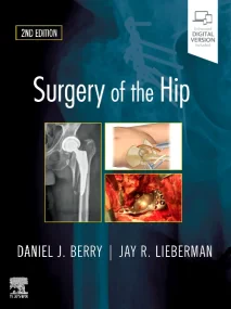 Surgery of the Hip, 2nd Edition