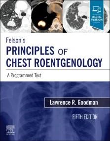 Felson's Principles of Chest Roentgenology, A Prog...