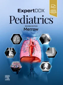 EXPERTddx: Pediatrics, 2nd Edition 
