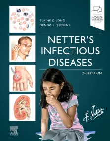 Netter’s Infectious Diseases