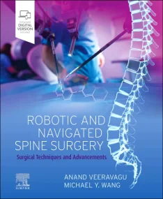Robotic and Navigated Spine Surgery: Surgical Tech...