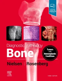 Diagnostic Pathology: Bone