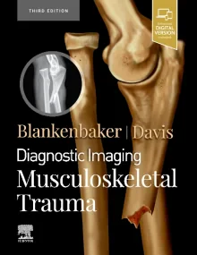 Diagnostic Imaging: Musculoskeletal Trauma, 3rd Ed...