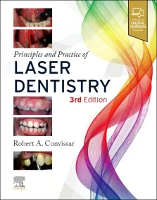 Principles and Practice of Laser Dentistry