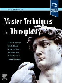 Master Techniques in Rhinoplasty