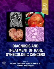 Diagnosis and Treatment of Rare Gynecologic Cancer...