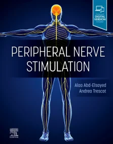Peripheral Nerve Stimulation: A Comprehensive Guid...