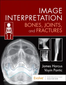 Image Interpretation: Bones, Joints, and Fractures...