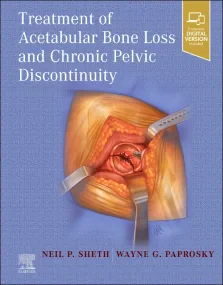 Treatment of Acetabular Bone Loss and Chronic Pelv...