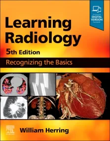 Learning Radiology: Recognizing the Basics