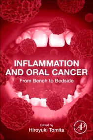 Inflammation and Oral Cancer