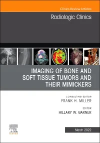 Imaging of Bone and Soft Tissue Tumors and Their M...
