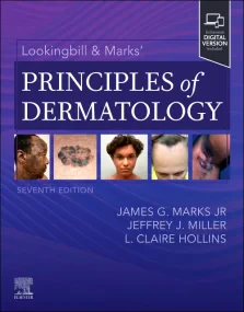 Lookingbill & Marksâ€™ Principles of Dermatology