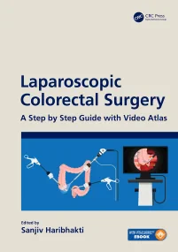 Laparoscopic Colorectal Surgery: A Step by Step Gu...