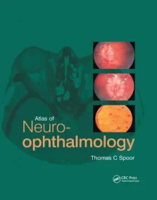 Atlas of Neuro-ophthalmology 