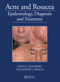 Acne and Rosacea: Epidemiology, Diagnosis and Trea...
