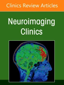 Management and Treatment of Cerebral Aneurysms, An...