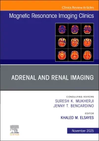 Adrenal and Renal Imaging, An Issue of Magnetic Re...