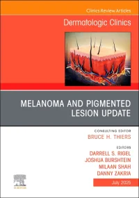 Melanoma and Pigmented Lesion Update, An Issue of ...