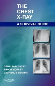 The Chest X-Ray: A Survival Guide