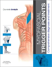 Myofascial Trigger Points: Comprehensive diagnosis...