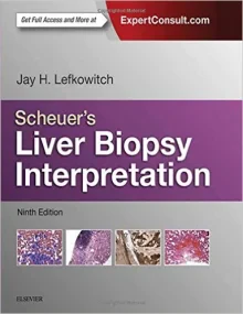 Scheuer’s Liver Biopsy Interpretation, 9e