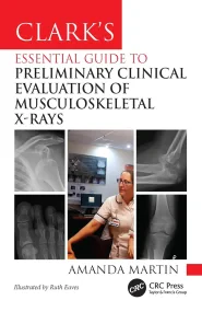 ClarkÂ’s Essential Guide to Preliminary Clinical E...