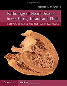 Pathology of Heart Disease in the Fetus, Infant an...