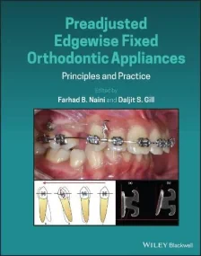 Preadjusted Edgewise Fixed Orthodontic Appliances:...