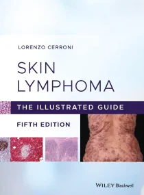 Skin Lymphoma: The Illustrated Guide